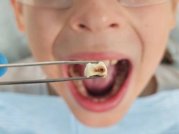 Best Emergency Dentist for Special Needs Patients in Walnut Grove, CA